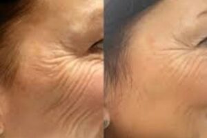 Best Plastic Surgeon in dubai