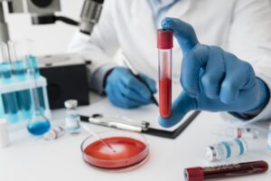 Book Blood Test Bangalore