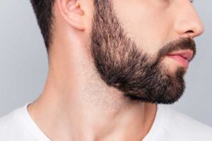 How Long Do Grafts Take to Settle in Beard Area?