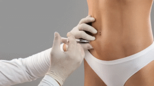 Does Aqualyx Injection Work on Small Fat Areas