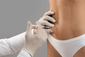 Does Aqualyx Injection Work on Small Fat Areas