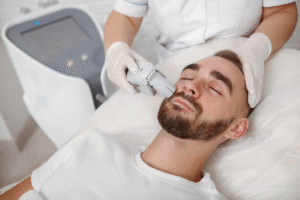 Is Beard Laser Hair Removal Approved by Dermatologists?