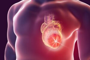 Ischemic Heart Disease Drugs Market