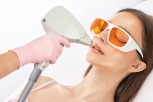 What Are the Benefits of Laser Hair Removal