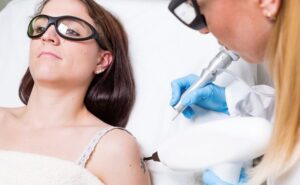 What Laser Tattoo Removal Feels Like During Treatment