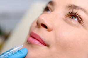 Are Russian Lip Fillers Suitable for Thin Lips Only