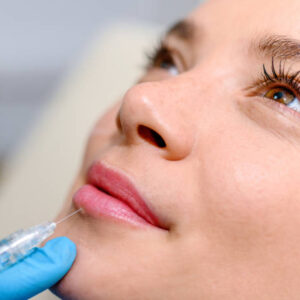 Are Russian Lip Fillers Suitable for Thin Lips Only