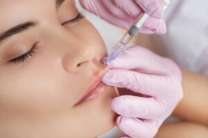 How Lip Fillers Help Boost Confidence Instantly