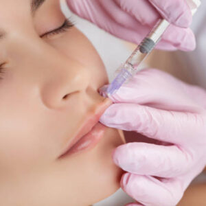 How Lip Fillers Help Boost Confidence Instantly