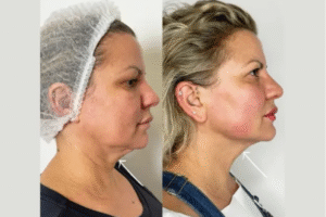The Best Plastic Surgeons in Dubai for Aesthetic Excellence