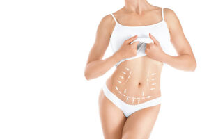 What Makes Bodytite Liposuction a Popular Choice