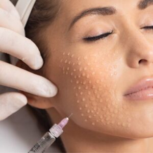 What to Expect After Skin Booster Injection Session