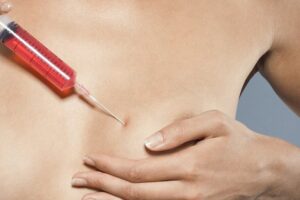 Why Breast Enlargement Injections Are in Demand