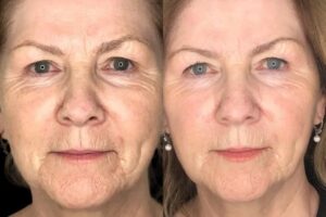 Best Plastic Surgeon in dubai