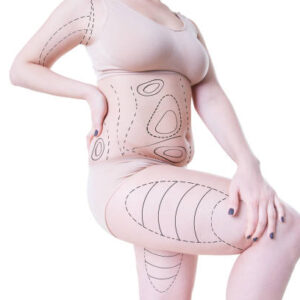 Is BodyTite Liposuction Safe for All Body Types