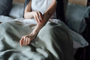 Is Eczema Treatment Safe for Sensitive Skin Types