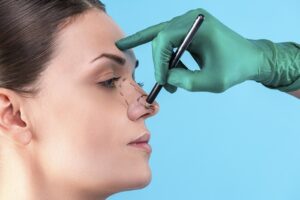 جراحة تجميل الأنف