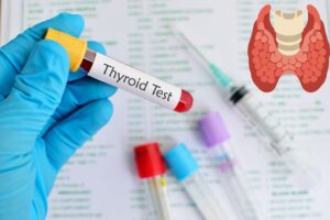 Thyroid Blood Test