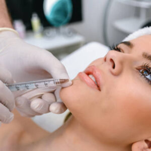 Why Choose Russian Lip Fillers for a Heart-Shaped Look
