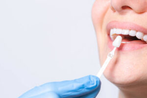 Are Dental Veneers the Best Fix for Uneven Smiles