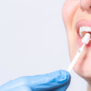 Are Dental Veneers the Best Fix for Uneven Smiles