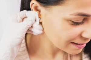Earlobe Surgery in Dubai
