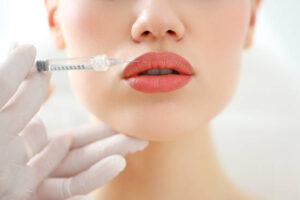 How Russian Lip Fillers Add Elegance to Every Smile