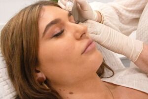 What Happens During AquaGold Fine Touch Sessions