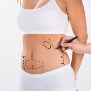 What Makes Tummy Tuck Ideal for Loose Belly Issues
