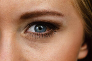 Why Eyelid Surgery Appeals to Eye-Area Concerns