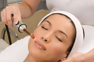 chemical peel treatment in Islamabad