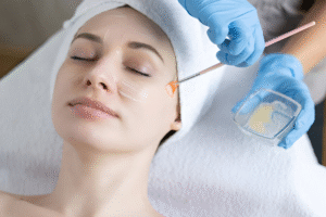 chemical peel in Islamabad