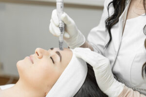 Microneedling Treatment in Islamabad